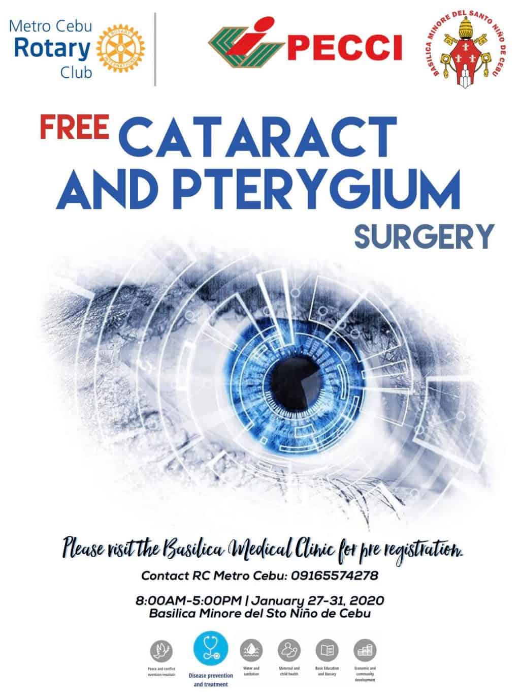 FREE Cataract and Pterygium surgery Basilica cebu