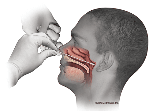 coronavirus-testing