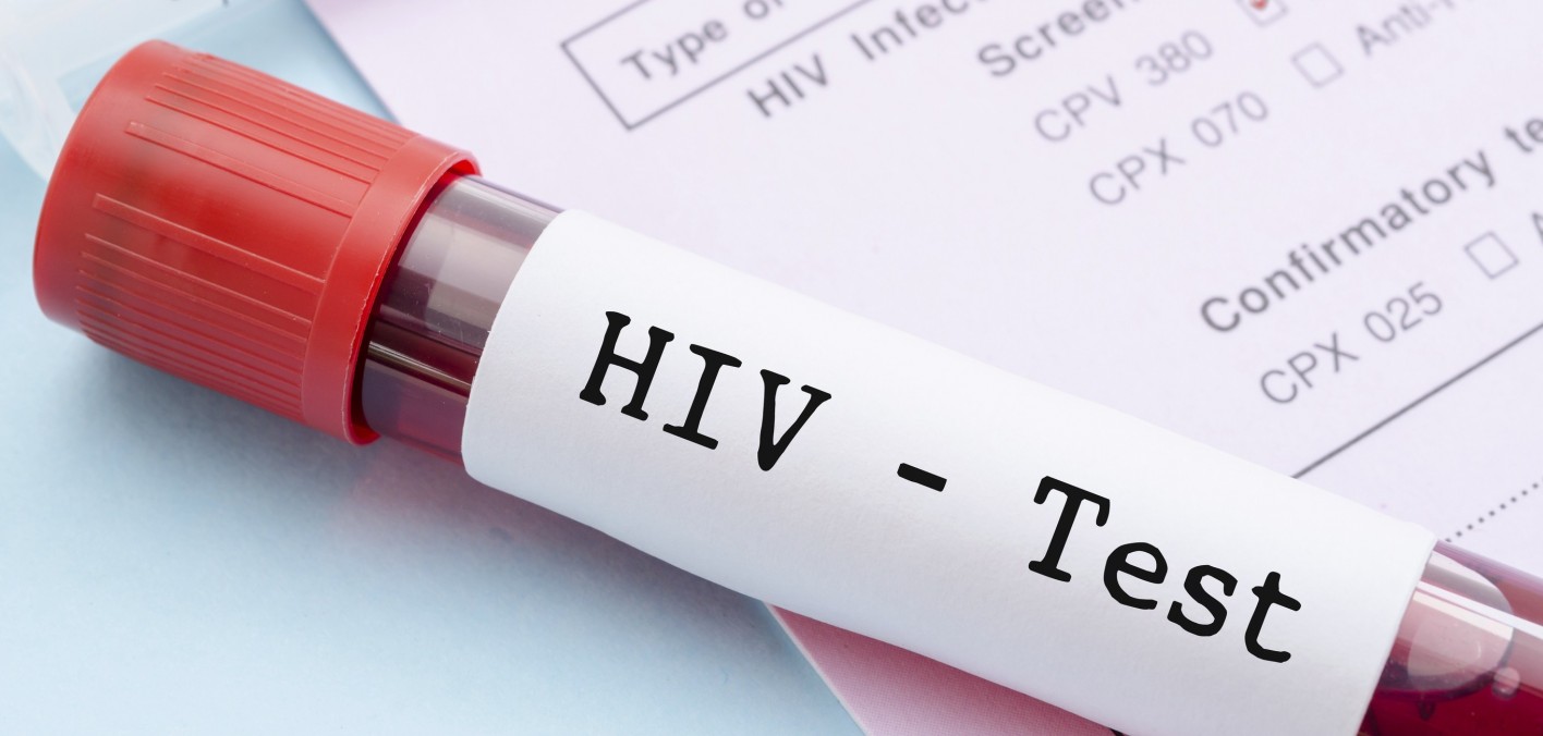 Free testing centers Cebu HIV STD